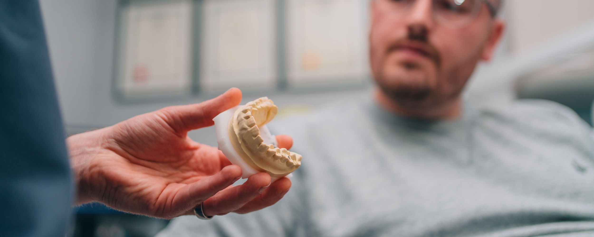 Replacing silver fillings