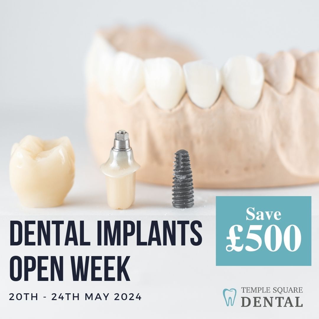 Dental Implants Open Week