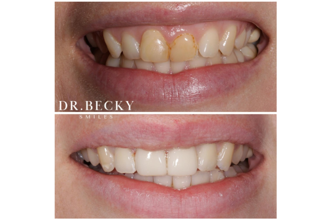 smilemakeover4