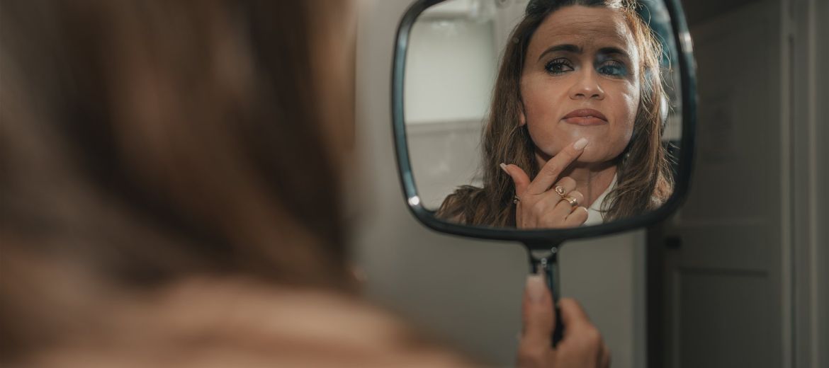 Smile makeover