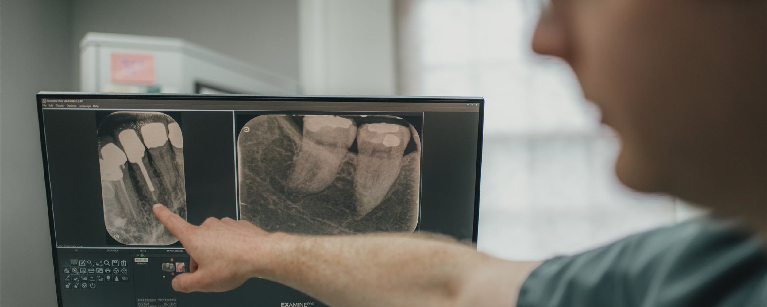 Bone and sinus treatment