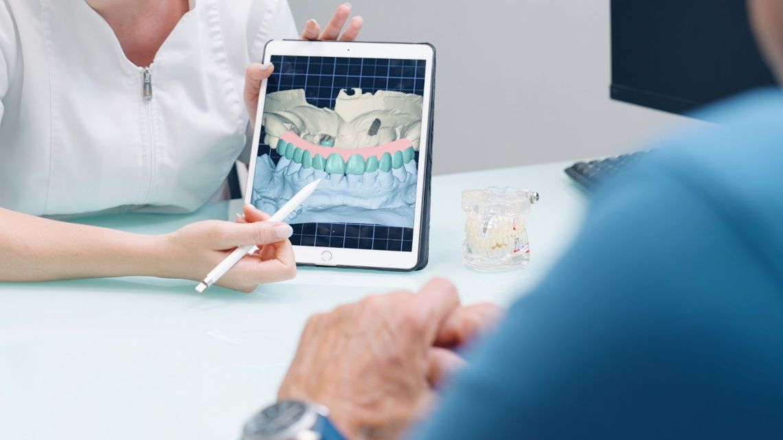 Dental Implant Open Event | May 11th–23rd 
