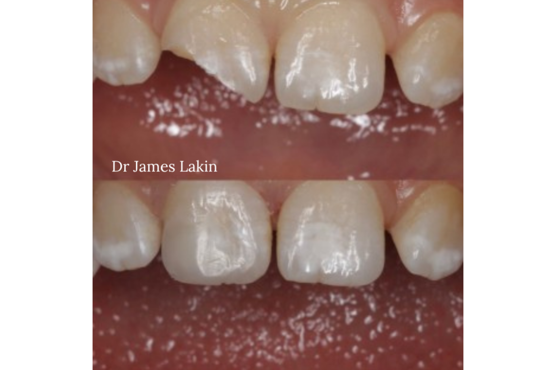 smilemakeover1