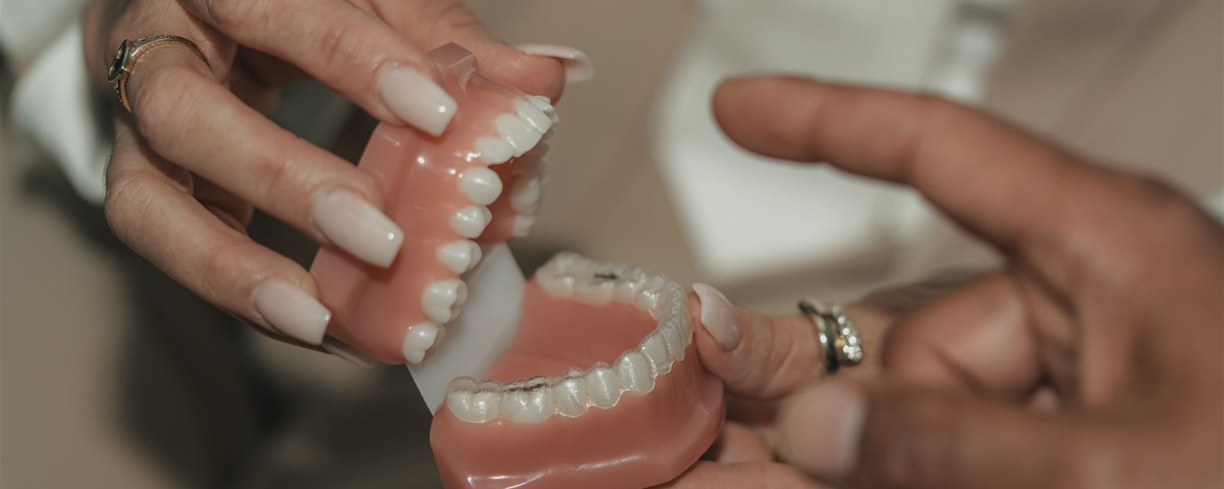 Multiple teeth dental implants