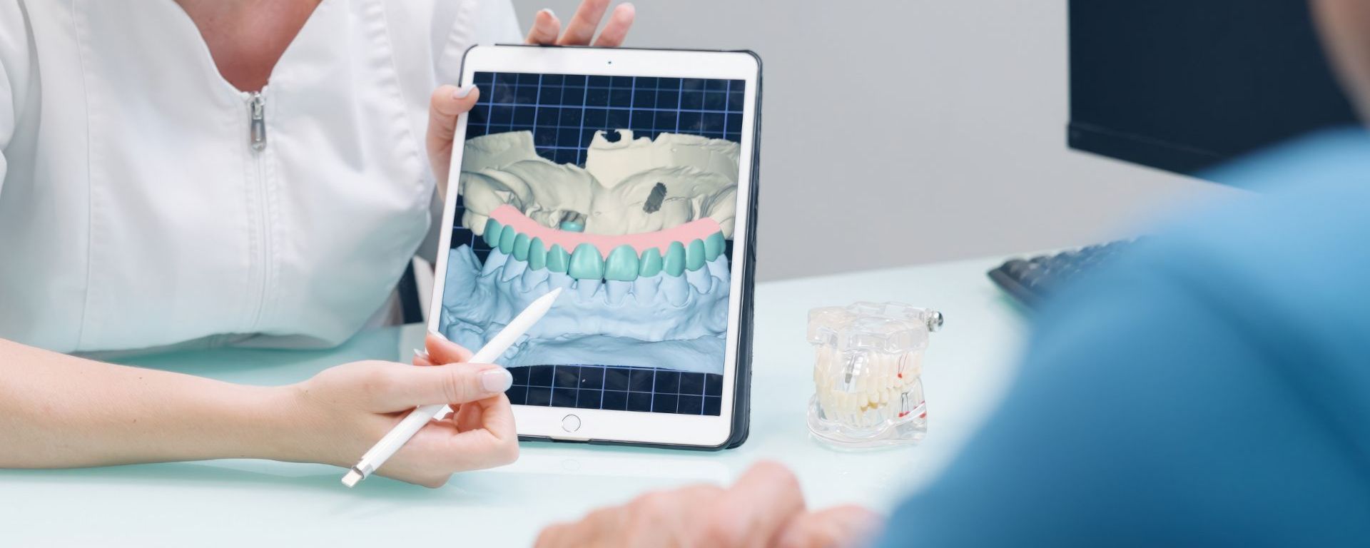 Dental Implant Open Event | May 11th–23rd 