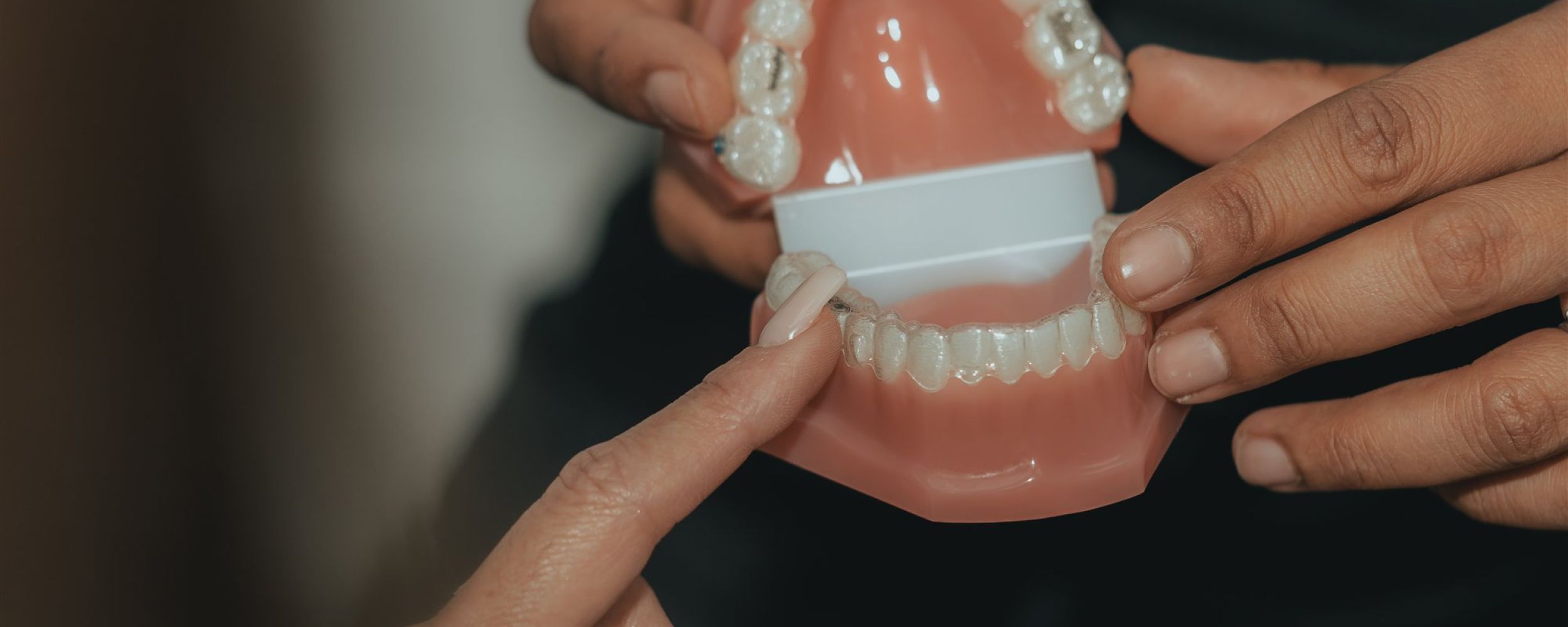 Traditional and trusted teeth straightening