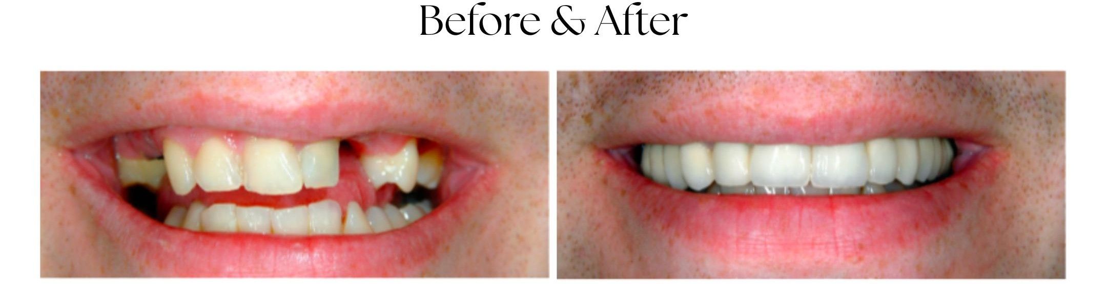 Before & After