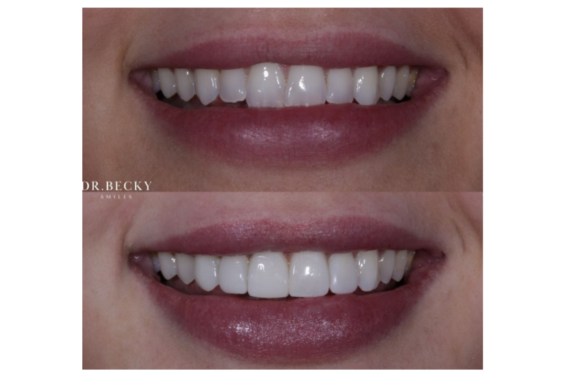 smilemakeover1