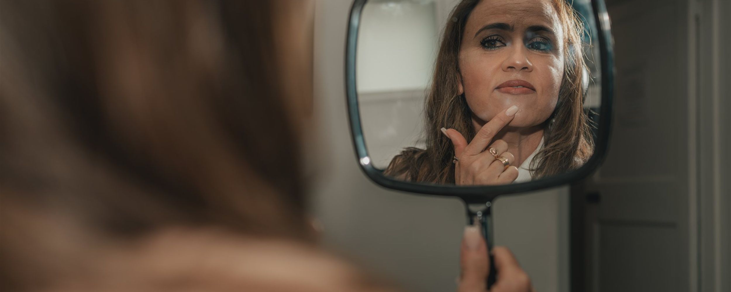Smile makeover
