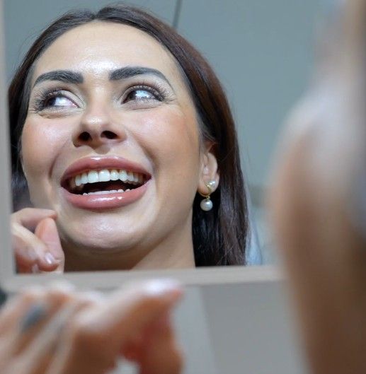 Smile Makeover